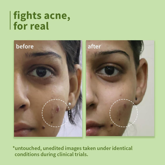 Plum Green Tea Pore Cleansing Face Wash